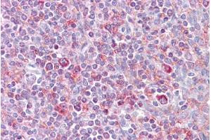 Immunohistochemistry (IHC) image for anti-V-Rel Reticuloendotheliosis Viral Oncogene Homolog B (RELB) (N-Term) antibody (ABIN2780784)