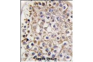 Immunohistochemistry (Paraffin-embedded Sections) (IHC (p)) image for anti-Microtubule-Associated Protein 1 Light Chain 3 alpha (MAP1LC3A) (AA 77-106), (C-Term) antibody (ABIN388474)