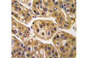 Immunohistochemistry (IHC) image for anti-Isocitrate Dehydrogenase 1 (NADP+), Soluble (IDH1) (AA 116-143) antibody (ABIN3031506)