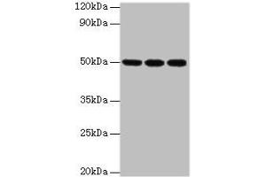 Western blot All lanes: HAT1 antibody at 3 μg/mL Lane 1: MCF-7 whole cell lysate Lane 2: 293T whole cell lysate Lane 3: HepG2 whole cell lysate Secondary Goat polyclonal to rabbit at 1/10000 dilution Predicted band size: 50, 40 kDa Observed band size: 50 kDa (HAT1 抗体  (Catalytic Subunit))