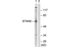 Western blot analysis of extracts from NIH-3T3 cells, treated with EGF 200ng/ml 30', using STAM2 (Ab-192) Antibody.