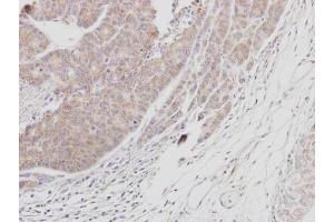 IHC-P Image Immunohistochemical analysis of paraffin-embedded SAS xenograft, using BTK, antibody at 1:100 dilution. (BTK 抗体  (C-Term))
