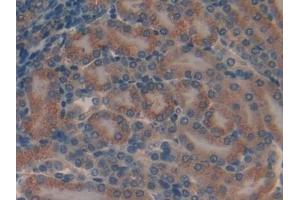 Immunohistochemistry (IHC) image for anti-Myosin IA (MYO1A) (AA 783-1043) antibody (ABIN7429532)