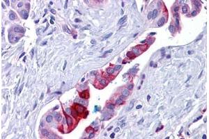 Human Pancreas, Duct: Formalin-Fixed, Paraffin-Embedded (FFPE) (Retinoblastoma Binding Protein 8 抗体  (Internal Region))