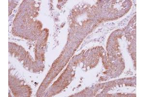 Image no. 1 for anti-Myotubularin Related Protein 9 (MTMR9) (AA 254-428) antibody (ABIN1499593) (MTMR9 抗体  (AA 254-428))
