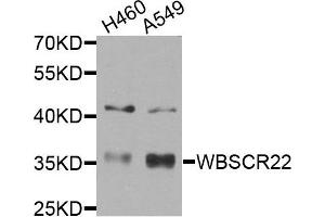 Western blot analysis of extracts of H460 and A549 cells, using WBSCR22 antibody. (WBSCR22 抗体)
