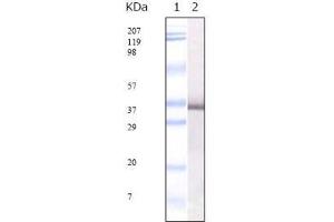 Western Blot showing SARS-E2GP3 antibody used against SARS-E2GP3 recombinant protein. (SARS-CoV E2 Glycoprotein 抗体)