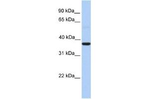 Western Blotting (WB) image for anti-Zinc Finger CCCH-Type Containing 15 (ZC3H15) (Middle Region) antibody (ABIN2784262)