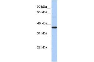 WB Suggested Anti-ZC3H15 Antibody Titration:  0. (ZC3H15 抗体  (Middle Region))