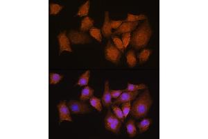 Immunofluorescence analysis of HeLa cells using NMN Rabbit pAb (ABIN7268910) at dilution of 1:100. (NMNAT3 抗体  (AA 1-215))