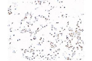 Immunocytochemistry (ICC) image for anti-Bromodomain Containing 4 (BRD4) (AA 1312-1362) antibody (ABIN7454019)