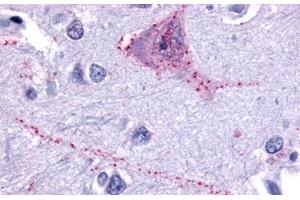 Anti-TACR3 antibody  ABIN1049391 IHC staining of human brain, neurons and glia. (TACR3 抗体  (N-Term))