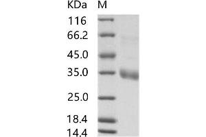 MERS-Coronavirus Spike Protein (MERS-CoV S) protein (His tag)