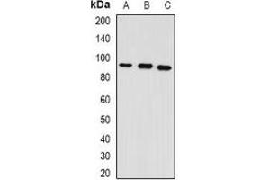 Western blot analysis of GPAM expression in mouse heart (A), mouse lung (B), rat brain (C) whole cell lysates. (GPAM 抗体)