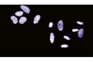 Immunofluorescent staining of HeLa cells. (SSB 抗体  (AA 179-289))