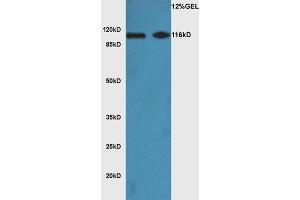 L1 mouse brain lysate L2 mouse heart lysates probed with Anti Phospho-ATG1(Ser556)Polyclonal Antibody, Unconjugated  at 1:3000 for 90 min at 37˚C. (ULK1 抗体  (pSer556))