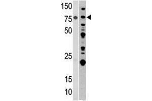 Image no. 1 for anti-Aconitase 2, Mitochondrial (ACO2) (Center) antibody (ABIN357262) (ACO2 抗体  (Center))