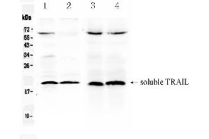 Western blot analysis of TRAIL using anti- TRAIL antibody .