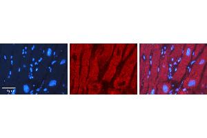 Rabbit Anti-XBP1 Antibody   Formalin Fixed Paraffin Embedded Tissue: Human heart Tissue Observed Staining: Cytoplasmic Primary Antibody Concentration: 1:100 Other Working Concentrations: 1:600 Secondary Antibody: Donkey anti-Rabbit-Cy3 Secondary Antibody Concentration: 1:200 Magnification: 20X Exposure Time: 0. (XBP1 抗体  (N-Term))