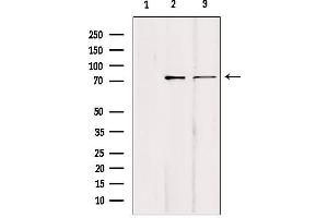 Western blot analysis of extracts from various samples, using KIFC1 Antibody. (KIFC1 抗体  (Internal Region))