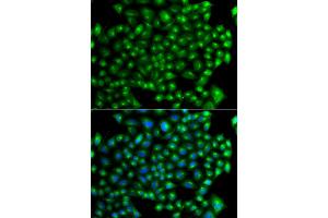 Immunofluorescence analysis of A549 cells using ZFYVE1 antibody (ABIN5975594). (ZFYVE1 抗体)