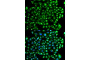Immunofluorescence analysis of A549 cells using ZFYVE1 antibody (ABIN5975594). (ZFYVE1 抗体)