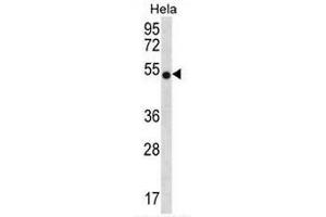 CHI3L2 Antibody (N-term) western blot analysis in Hela cell line lysates (35µg/lane). (CHI3L2 抗体  (N-Term))