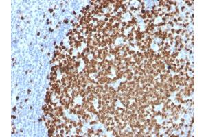 Formalin-fixed, paraffin-embedded human Tonsil stained with Ki67 Mouse Monoclonal Antibody (MKI67/2461). (Ki-67 抗体  (AA 2293-2478))