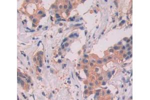 Used in DAB staining on fromalin fixed paraffin- embedded breast tissue (MYH11 抗体  (AA 162-315))