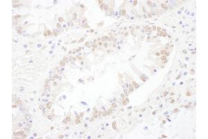 anti-Small Nuclear Ribonucleoprotein 200kDa (U5) (SNRNP200) (AA 1-50) antibody