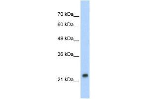 WB Suggested Anti-HSPB1 Antibody Titration: 1. (HSP27 抗体  (C-Term))