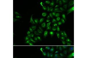 Immunofluorescence analysis of U2OS cells using TSPAN7 Polyclonal Antibody (Tetraspanin 7 抗体)