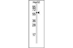 Image no. 1 for anti-Aldehyde Dehydrogenase 3 Family, Member B1 (ALDH3B1) (Middle Region) antibody (ABIN360240) (ALDH3B1 抗体  (Middle Region))
