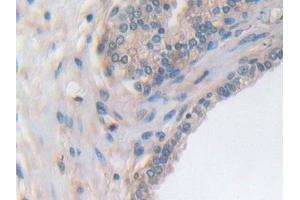 Immunohistochemistry (IHC) image for anti-Utrophin (UTRN) (AA 1-252) antibody (ABIN7443953)