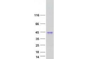 Western Blotting (WB) image for Carbonic Anhydrase VI (CA6) protein (Myc-DYKDDDDK Tag) (ABIN2713134)