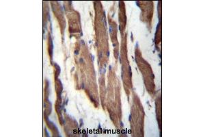 TGFBR Antibody (C-term) 3395b immunohistochemistry analysis in formalin fixed and paraffin embedded human skeletal muscle followed by peroxidase conjugation of the secondary antibody and DAB staining. (TGFBRAP1 抗体  (C-Term))