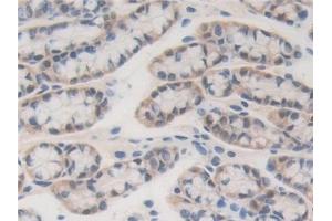 Immunohistochemistry (IHC) image for anti-Bromodomain Containing 8 (BRD8) (AA 797-951) antibody (ABIN7443590)