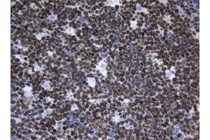 Image no. 3 for anti-Antigen Identified By Monoclonal Antibody Ki-67 (MKI67) (AA 1160-1493) antibody (ABIN1490856)