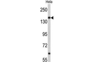 Western Blotting (WB) image for anti-Nucleoporin 153kDa (NUP153) antibody (ABIN3004036)