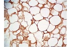 Rat visceral fat tissue was stained by Rabbit Anti-Cathepsin S (298-331) (Human) Serum (Cathepsin S 抗体  (AA 298-331))