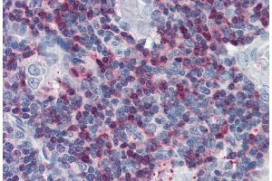 Immunohistochemistry (Paraffin-embedded Sections) (IHC (p)) image for anti-Lymphocyte Cytosolic Protein 2 (SH2 Domain Containing Leukocyte Protein of 76kDa) (LCP2) (AA 216-434) antibody (ABIN94501)