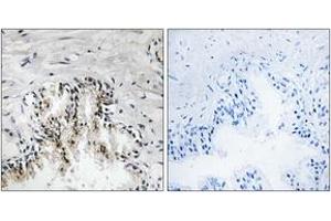 Immunohistochemistry analysis of paraffin-embedded human prostate carcinoma tissue, using RPL31 Antibody. (RPL31 抗体  (AA 61-110))