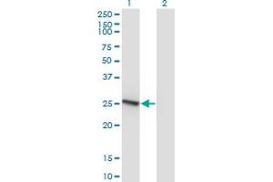 Western Blot analysis of RAB32 expression in transfected 293T cell line by RAB32 monoclonal antibody (M01), clone 1C7. (RAB32 抗体  (AA 136-225))