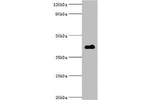 Western blot Western blot All lanes: Histone deacetylase 8 antibody at 2 μg/mL + Hela whole cell lysate Secondary Goat polyclonal to rabbit IgG at 1/10000 dilution Predicted band size: 42, 30, 18, 32, 29, 16, 17 kDa Observed band size: 42 kDa (HDAC8 抗体  (AA 1-377))