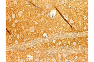 ABIN6265408 and ABIN6268871 at 1/100 staining Rat lung tissue by IHC-P. (beta Synuclein 抗体  (C-Term))