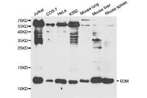 Western blot analysis of extracts of various cell lines, using B2M antibody. (beta-2 Microglobulin 抗体  (AA 21-119))