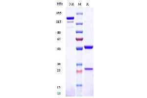 Anti-TNFRSF10B / TRAILR2 / CD262 Reference Antibody (drozitumab) on SDS-PAGE under reducing (R) condition. (Recombinant TNFRSF10B (Drozitumab Biosimilar) 抗体)