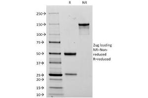 SDS-PAGE (SDS) image for anti-Neural Cell Adhesion Molecule 1 (NCAM1) antibody (ABIN3026427)