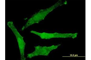 Immunofluorescence of monoclonal antibody to SNAP29 on HeLa cell. (SNAP29 抗体  (AA 1-258))