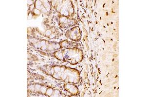 Immunohistochemistry of paraffin embedded rat colon using NAIF1 (ABIN7074867) at dilution of 1:2500 (400x lens) (NAIF1 抗体)